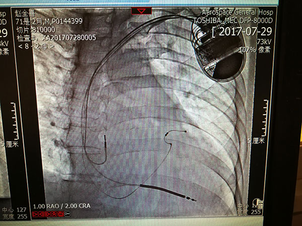 心內(nei)科(ke)新(xin)技(ji)術(shù)照片1.jpg 心內(nei)科(ke)新(xin)技(ji)術(shù)照片1.jpg