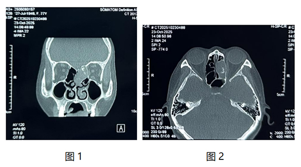 微信(xin)圖片_20251110114814.jpg 微信(xin)圖片_20251110114814.jpg